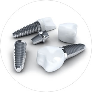 Implanty zębów Ursynów